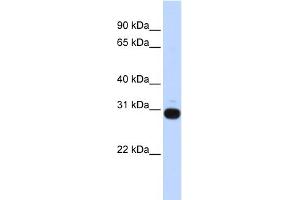 WB Suggested Anti-VASH1 Antibody Titration: 0. (VASH1 Antikörper  (Middle Region))