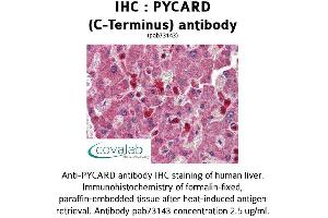 Image no. 1 for anti-PYD and CARD Domain Containing (PYCARD) (C-Term) antibody (ABIN1738638) (PYCARD Antikörper  (C-Term))