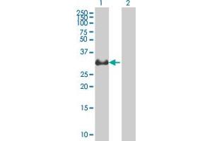 Western Blotting (WB) image for VWF 293T Cell Transient Overexpression Lysate(Denatured) (ABIN1333896)