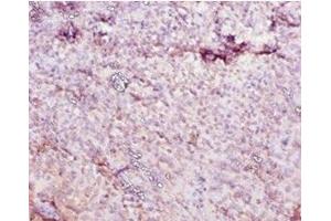 Immunohistochemistry of paraffin-embedded human tonsil tissue using ABIN7177073 at dilution of 1:10 (CES1C Antikörper  (AA 19-550))