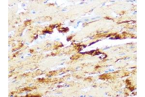Immunohistochemistry of paraffin-embedded mouse heart using Myosin heavy chain Rabbit mAb (ABIN7268750) at dilution of 1:100 (40x lens). (MYH7 Antikörper)