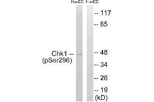 Immunohistochemistry analysis of paraffin-embedded human brain tissue using Chk1 (Phospho-Ser296) antibody. (CHEK1 Antikörper  (pSer296))