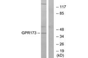Western blot analysis of extracts from K562 cells, using GPR173 Antibody. (GPR173 Antikörper  (AA 251-300))