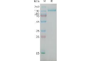 NG2 Protein (AA 1538-2221) (mFc Tag)