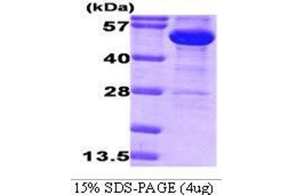 Glucose-6-Phosphate Dehydrogenase Protein (G6PD) (AA 1-491)