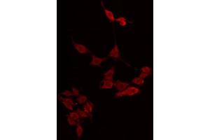 ABIN6274858 staining LOVO by IF/ICC. (Apolipoprotein L 4 Antikörper)
