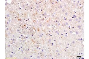 Formalin-fixed and paraffin embedded rat brain tissue labeled with Anti-APOE4/Apolipoprotein E4 Polyclonal Antibody, Unconjugated (ABIN708746) at 1:200 followed by conjugation to the secondary antibody (APOE Antikörper  (AA 101-200))