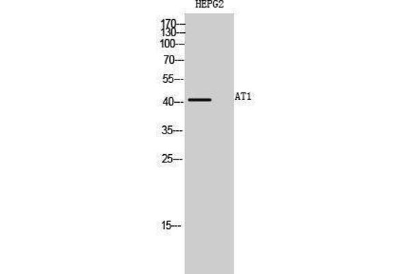 AGTR1a Antikörper  (Internal Region)