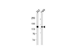 Lane 1: 293 Cell lysates, Lane 2: HeLa Cell lysates, probed with MSH2 (1184CT1. (MSH2 Antikörper)