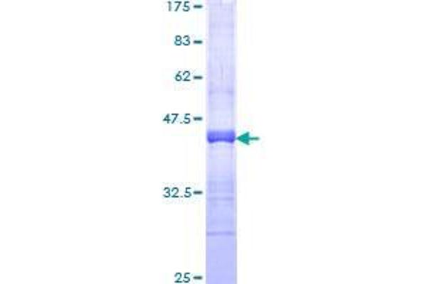 RNF150 Protein (AA 67-176) (GST tag)