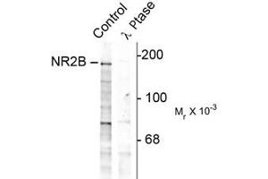 Image no. 1 for anti-Glutamate Receptor, Ionotropic, N-Methyl D-Aspartate 2B (GRIN2B) (pTyr1252) antibody (ABIN303962) (GRIN2B Antikörper  (pTyr1252))