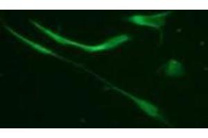 Immunofluorescence (IF) image for anti-Vimentin (VIM) (pSer33) antibody (ABIN1449152) (Vimentin Antikörper  (pSer33))