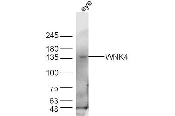 WNK4 Antikörper  (AA 351-450)