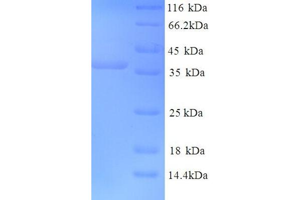 GRIK5 Protein (AA 143-238, Extracellular) (GST tag)