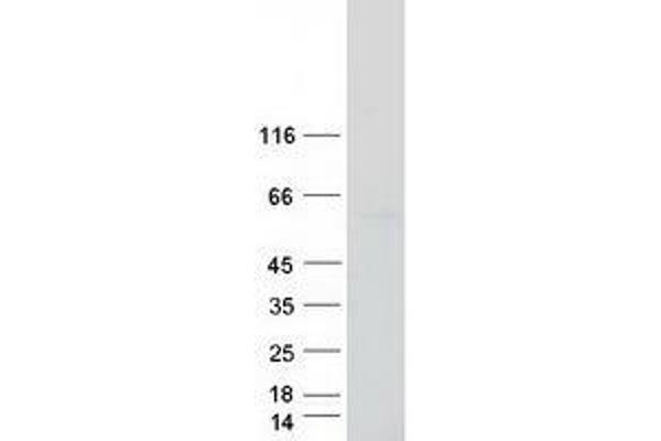 ZSCAN4 Protein (Myc-DYKDDDDK Tag)