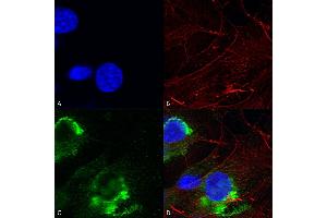 Immunocytochemistry/Immunofluorescence analysis using Mouse Anti-GFAP R416WT Monoclonal Antibody, Clone S206B-9 (ABIN1740978). (GFAP Antikörper  (AA 411-422) (PerCP))