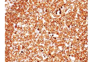 Formalin-fixed, paraffin-embedded human Tonsil stained with CD79a Monoclonal Antibody (SPM549) (CD79a Antikörper  (AA 202-216))