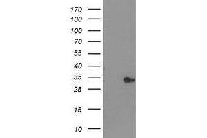 Western Blotting (WB) image for anti-Haloacid Dehalogenase-Like Hydrolase Domain Containing 2 (HDHD2) antibody (ABIN1498627) (HDHD2 Antikörper)