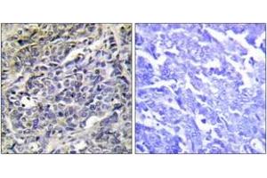 Immunohistochemistry (IHC) image for anti-Granzyme K (Granzyme 3, Tryptase II) (GZMK) (AA 61-110) antibody (ABIN2889995) (GZMK Antikörper  (AA 61-110))