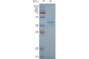 SDS-PAGE (SDS) image for STING1 protein (ABIN7538538)