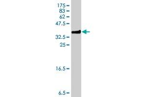 Western Blot detection against Immunogen (34. (S100A6 Antikörper  (AA 18-90))