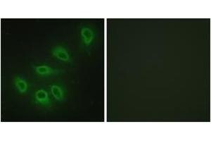 Immunofluorescence analysis of HeLa cells, using eNOS (Ab-1179) Antibody. (ENOS Antikörper  (AA 1145-1194))