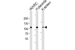 Western blot analysis of lysates from HUVEC cell line , huamn placenta and spleen tissue lysate(from left to right), using GP1BA(Glycocalicin) Antibody (Center) (ABIN6242723 and ABIN6577497). (CD42b Antikörper  (AA 344-378))