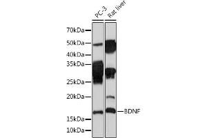 Western blot analysis of extracts of various cell lines, using BDNF Rabbit mAb (ABIN7265916) at 1:1000 dilution. (BDNF Antikörper)