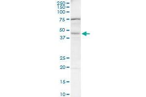 BAAT monoclonal antibody (M03), clone 1E4. (BAAT Antikörper  (AA 258-355))