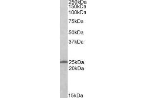 Western Blotting (WB) image for anti-RAN, Member RAS Oncogene Family (RAN) antibody (ABIN5876166) (RAN Antikörper)