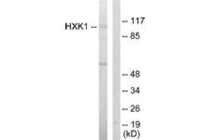 Western Blotting (WB) image for anti-Hexokinase 1 (HK1) (AA 31-80) antibody (ABIN2889414) (Hexokinase 1 Antikörper  (AA 31-80))
