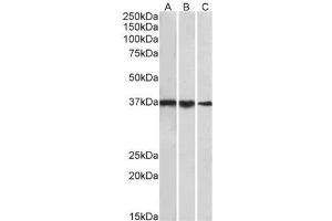 P31930PU-N TBP antibody staining of cell line NIH3T3 (A), Mouse Testis (B) and Rat Testis (C) lysates at 1 µg/ml (35µg protein in RIPA buffer). (TBP Antikörper  (Internal Region))