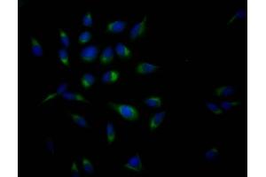 Immunofluorescence staining of Hela Cells with ABIN7127338 at 1:50, counter-stained with DAPI. (Rekombinanter APP Antikörper)