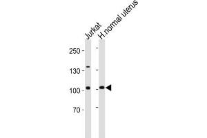 Western Blotting (WB) image for anti-Telomerase Reverse Transcriptase (TERT) antibody (ABIN2997736) (TERT Antikörper)