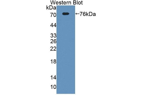 ECM1 Antikörper  (AA 20-434)