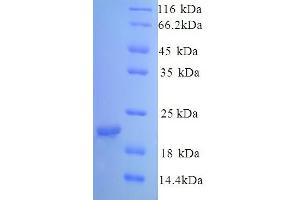 SDS-PAGE (SDS) image for Caveolin 1, Caveolae Protein, 22kDa (CAV1) (AA 1-178) protein (His tag) (ABIN5713316) (Caveolin-1 Protein (AA 1-178) (His tag))