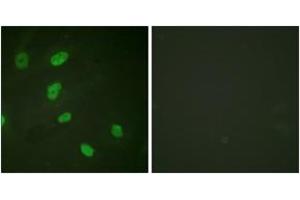 Immunofluorescence analysis of HeLa cells, using Histone H2B (Acetyl-Lys5) Antibody. (Histone H2B Antikörper  (acLys5))