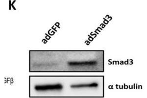 Western Blotting (WB) image for anti-alpha Tubulin (TUBA1) (C-Term) antibody (ABIN964563)