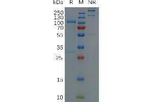 Human A Protein, hFc Tag on SDS-PAGE under non-reducing (NR) and reducing (R) conditions. (ADAM9 Protein (AA 29-697) (Fc Tag))