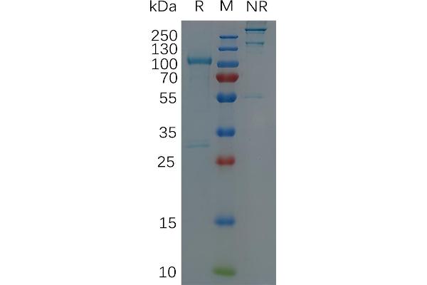 ADAM9 Protein (AA 29-697) (Fc Tag)