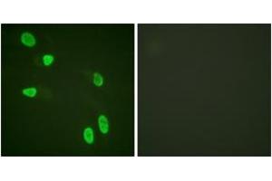 Immunofluorescence analysis of HeLa cells, using Histone H4 (Ab-8) Antibody. (Histone H4 Antikörper  (AA 6-55))