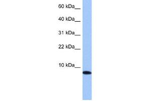 WB Suggested Anti-TNP1 Antibody Titration: 0. (TNP1 Antikörper  (N-Term))
