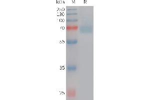 Human ACHE Protein, His Tag on SDS-PAGE under reducing condition. (Acetylcholinesterase Protein (AChE) (AA 32-614) (His tag))