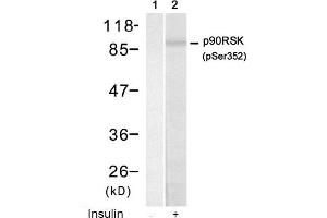 Image no. 1 for anti-Ribosomal Protein S6 Kinase, 90kDa, Polypeptide 1 (RPS6KA1) (pSer352) antibody (ABIN319222) (RPS6KA1 Antikörper  (pSer352))