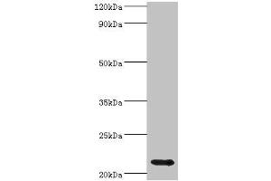 Western blot All lanes: Heat shock protein beta-8 antibody at 4 μg/mL + Rat heart tissue Secondary Goat polyclonal to rabbit IgG at 1/10000 dilution Predicted band size: 22 kDa Observed band size: 22 kDa (HSPB8 Antikörper  (AA 1-196))