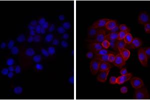 Immunofluorescence (IF) image for Donkey anti-Mouse IgG (Heavy & Light Chain) antibody (ABIN376976)