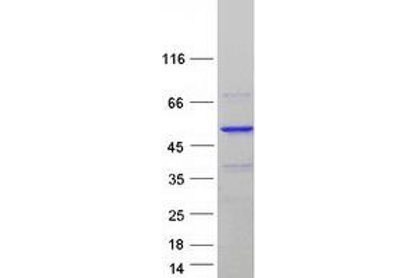 POLDIP3 Protein (Transcript Variant 1) (Myc-DYKDDDDK Tag)