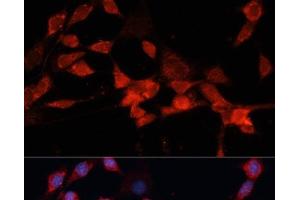 Immunofluorescence analysis of NIH-3T3 cells using DDB1 Polyclonal Antibody at dilution of 1:100 (40x lens). (DDB1 Antikörper)