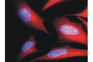 Immunofluorescence (IF) image for anti-alpha Tubulin (TUBA1) antibody (FITC) (ABIN93892)