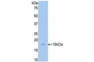 Detection of Recombinant CST3, Rat using Polyclonal Antibody to Cystatin C (Cys-C) (CST3 Antikörper  (AA 21-140))